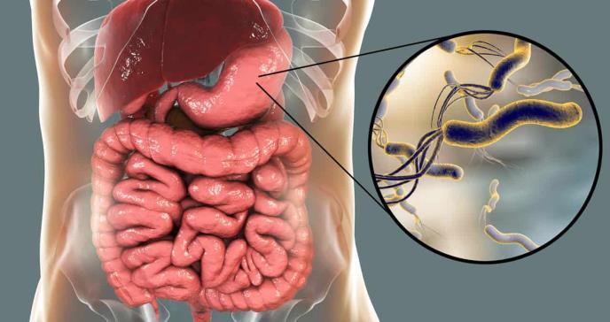 Un estudio revela la gran resistencia de la Helicobacter pylori a los antibióticos